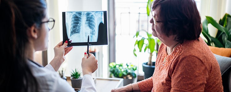 doctor explain xray results with mesothemliona patient 